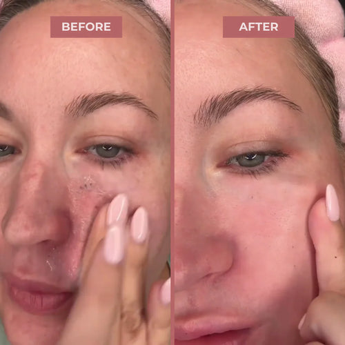 Dr. Melaxin Glow RiceGlass Skin Premium Kit (6 Pcs)™