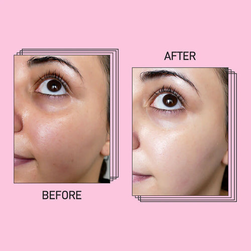 Dr. Melaxin Glow RiceGlass Skin Premium Kit (6 Pcs)™