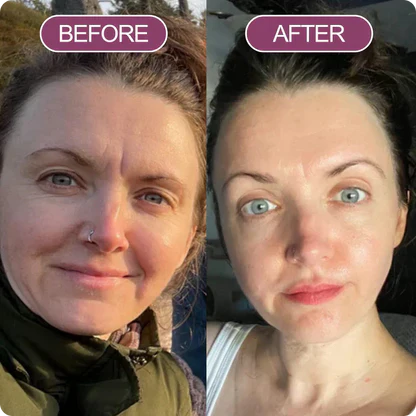 Radiant Skin Care Balm Set™