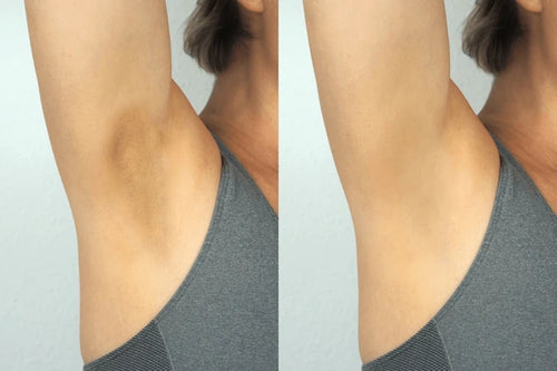 Glass Skin Renewal Kit (6 Pcs)™