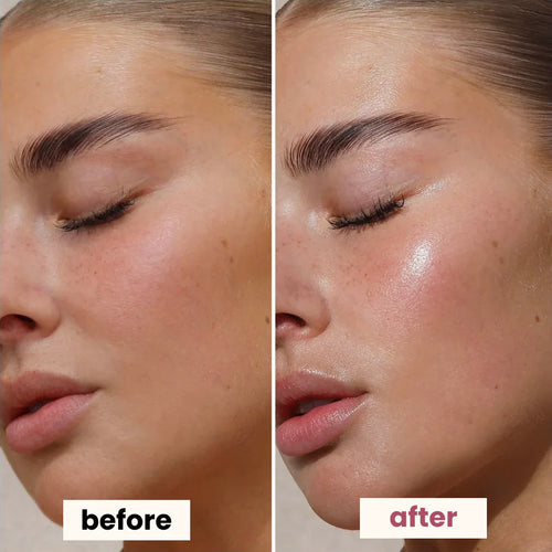 Dr. Melaxin Glow RiceGlass Skin Premium Kit (6 Pcs)™